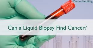 Can a liquid biopsy find cancer